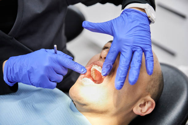 Best Dental Abscess Treatment in Loudonville, OH