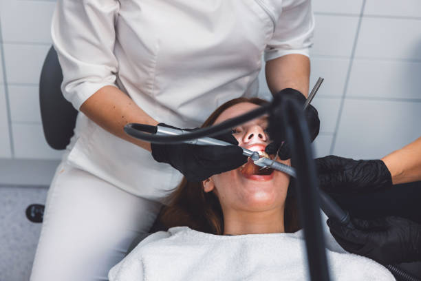 Best Knocked-Out Tooth (Avulsed Tooth) Treatment in Loudonville, OH